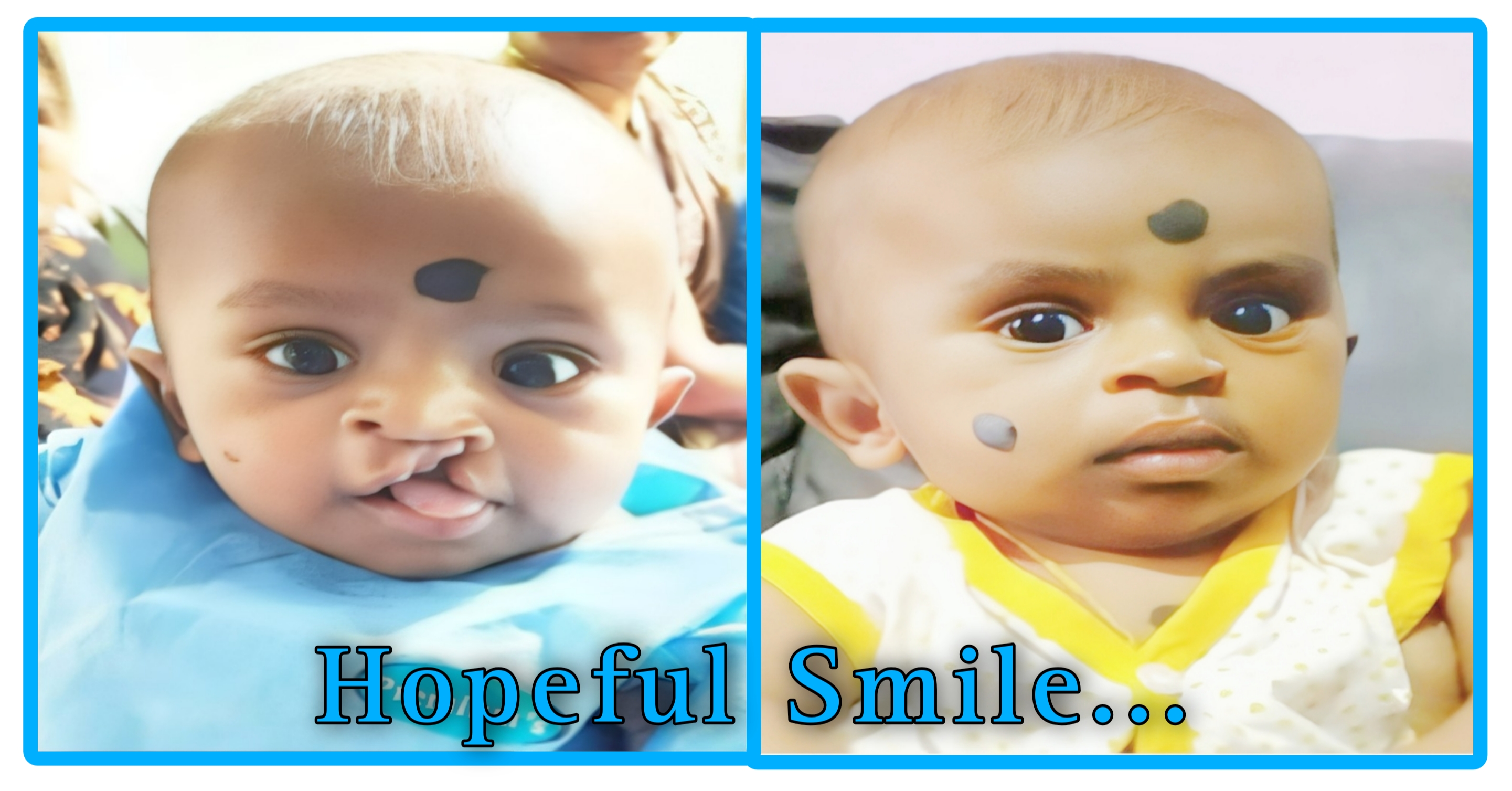 Cleft Lip and Cleft Palate Care Initiative